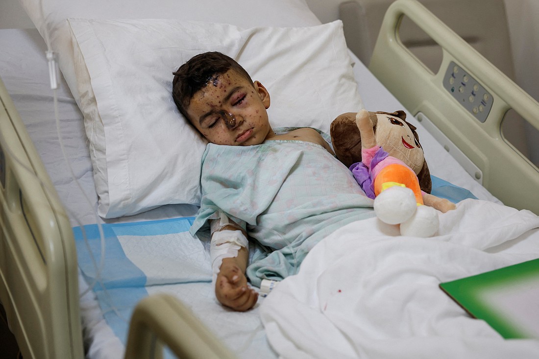 Four-year-old Qassem Hussein, who lost his father in an Israeli airstrike, is treated at the Maritime Hospital in the town of Jbeil, Lebanon, north of Beirut, Sept. 26, 2024. (OSV News photo/Louisa Gouliamaki, Reuters)