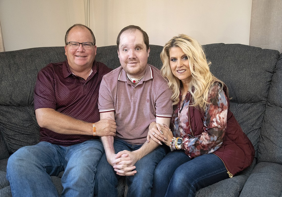 Face transplant patient Derek Pfaff, center, poses with his parents, Jerry and Lisa Pfaff, at their home in Harbor Beach, Mich., Oct. 19, 2019. In March 2014, Derek tried to take his life by shooting himself in the face with his shotgun. In February 2024, Derek received a rare face transplant at the Mayo Clinic in Rochester, Minn. (OSV News photo/courtesy Jeff Schrier).