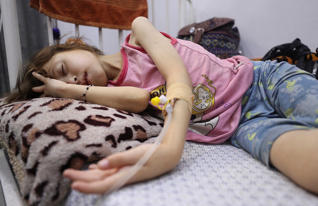 Young Palestinian Ana Ayad, who is malnourished, according to medics, lies on a bed July 29, 2025, as she receives treatment at a hospital in Gaza City, Gaza Strip, amid a worsening hunger crisis. OSV News photo/Mahmoud Issa, Reuters