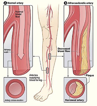 Lourdes Medical Center expands vascular services