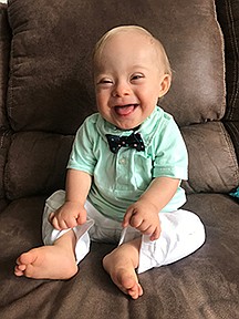 'Gerber baby' breaks barriers for special-needs persons