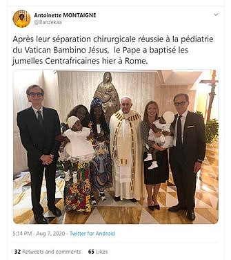 Pope baptizes twins after successful surgery to separate them