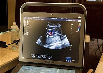 Doctors: Advances since Roe confirm abortion 'takes life of unborn child'